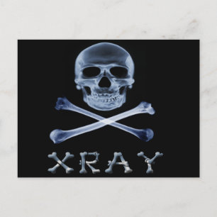 Carte Postale Jolly roger RADIOLOGIE Drapeau XRAY PIRATE