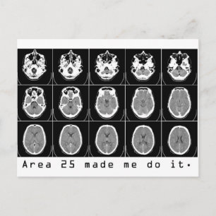 Carte Postale La zone 25 m'a fait le faire.