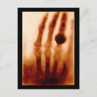 Le premier X-Ray, 1901, photo