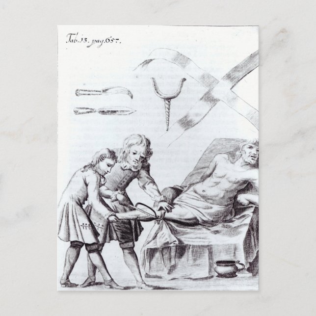 Carte Postale Opération chirurgicale pour amputer une jambe (Devant)
