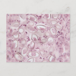 Carte Postale Parasite scientifique