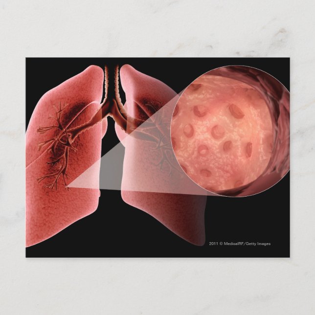 Carte Postale Piste gonflée pendant une crise d'asthme (Devant)