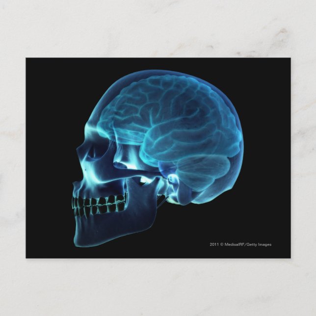 Carte Postale Radiographie du cerveau à l'intérieur d'un crâne (Devant)