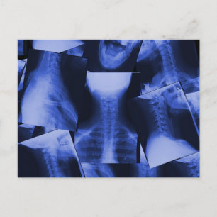Carte Postale Rayé X - Bleu électromagnétique
