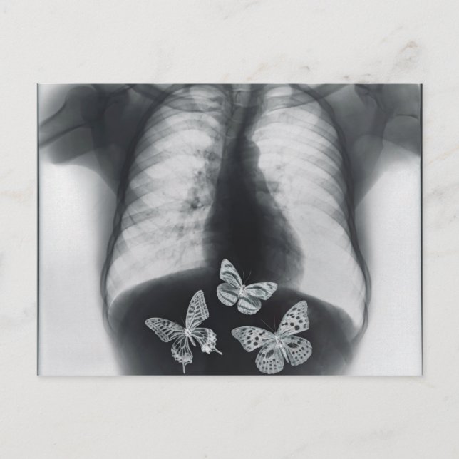 Carte Postale rayons X de papillons dans l'estomac (Devant)