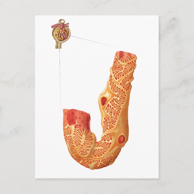Carte Postale Renal Corpuscle Et L'Membrane De Filtration (Devant)