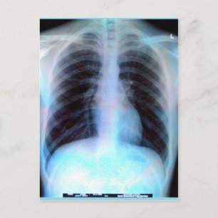 Carte Postale Ribcage Xray Skeleton