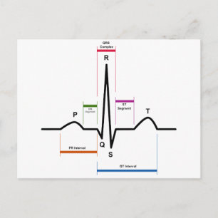 Carte Postale Rythme sinus dans un diagramme ECG d'électrocardio