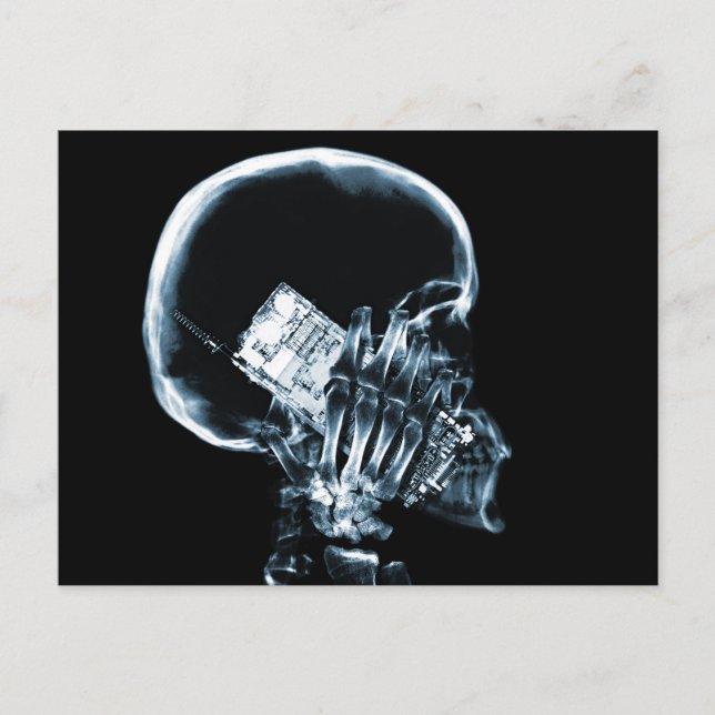 CARTE POSTALE SKELETON X-RAY AU TÉLÉPHONE - BLEU (Devant)