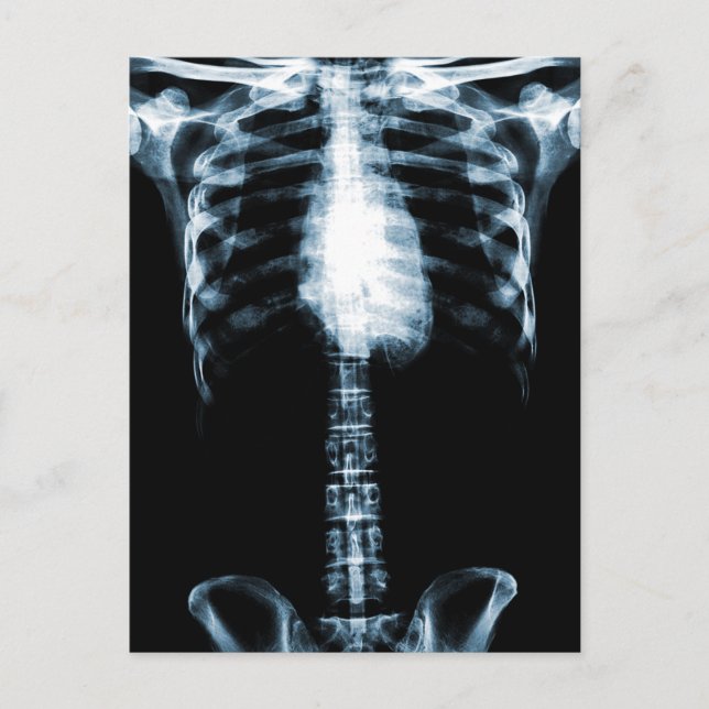 CARTE POSTALE SKELETON X-RAY TORSO RIBS BLUE (Devant)