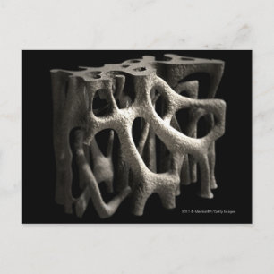 Carte Postale Structure d'un os avec ostéoporose