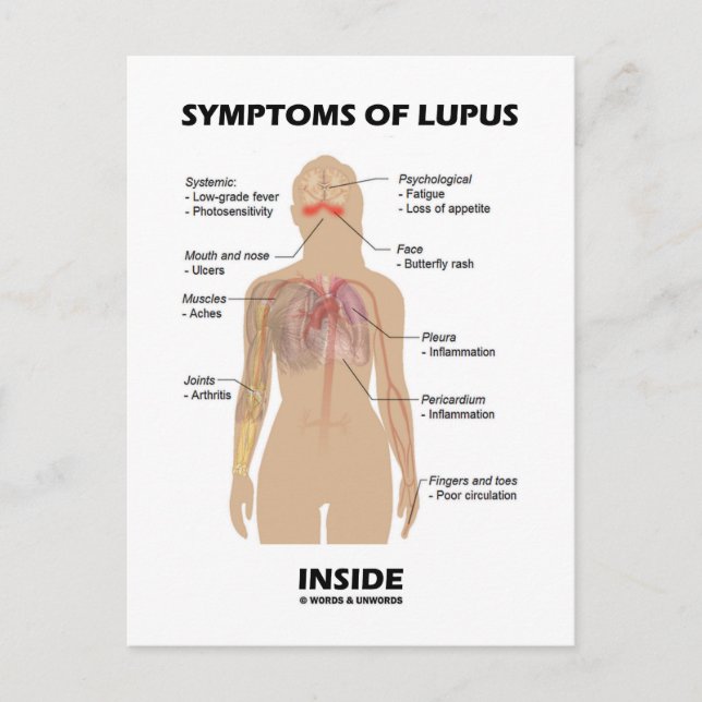 Carte Postale Symptômes Du Lupus À L'Intérieur (Trouble Autoimmu (Devant)