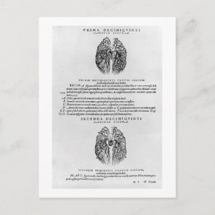 Carte Postale Système vasculaire du cerveau