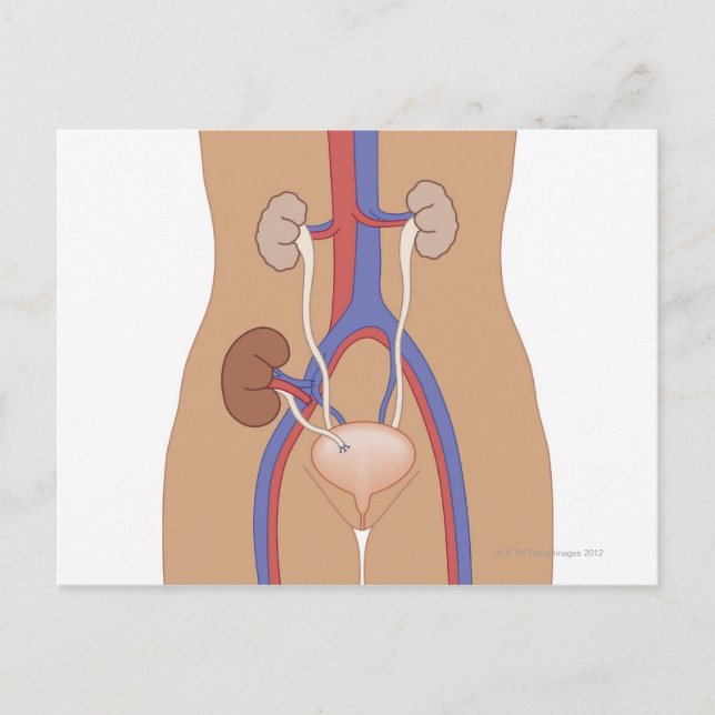 Carte Postale Transplantation rénale (Devant)