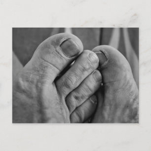 Carte Postale Ugly Feet