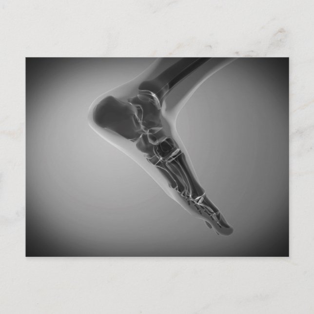 Carte Postale Vue En Rayon X Du Pied Humain 4 (Devant)