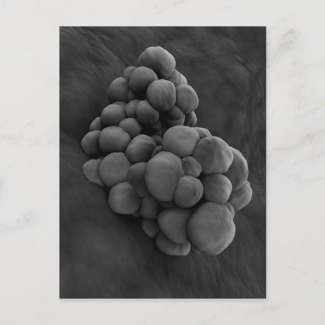 Carte Postale Vue Microscopique De La Tumeur 1 (Devant)