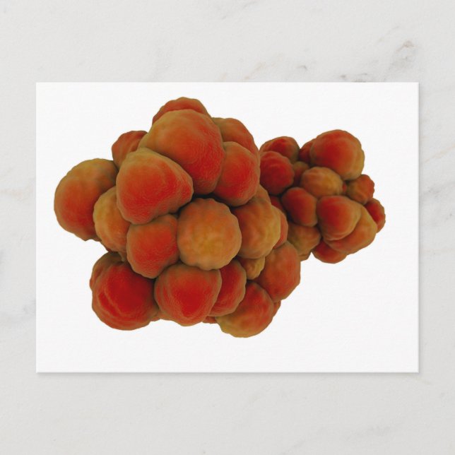 Carte Postale Vue Microscopique De La Tumeur 4 (Devant)