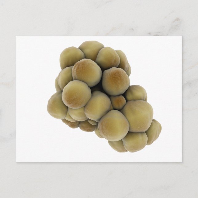 Carte Postale Vue Microscopique De La Tumeur 5 (Devant)