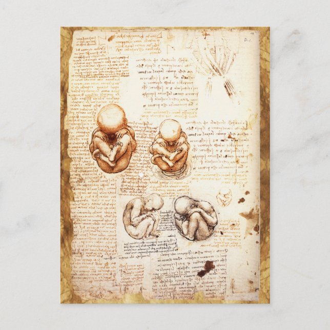 Carte Postale Vues d'un foetus dans l'utérus, Ob-Gyn Médicale (Devant)