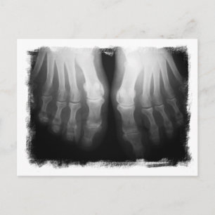Carte Postale X-Ray Pieds humains Skeleton Bones noir et blanc