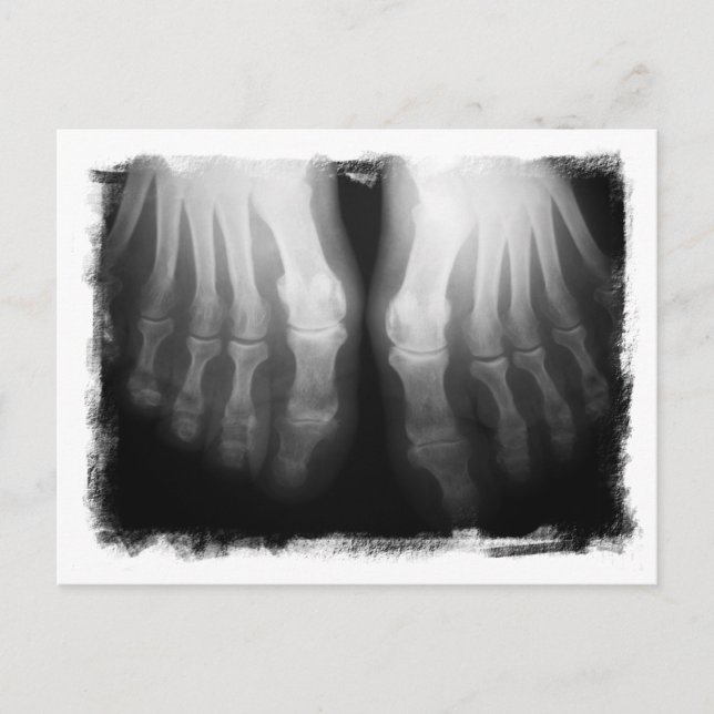 Carte Postale X-Ray Pieds humains Skeleton Bones noir et blanc (Devant)
