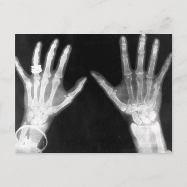 Carte Postale X-Ray Skeleton Mains et bijoux - B&W (Devant)