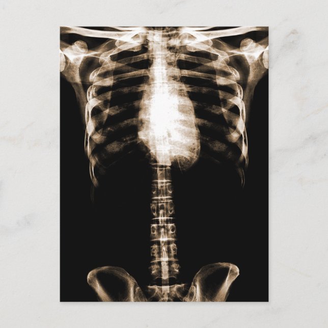 CARTE POSTALE XRAY SKELETON TORSO RIBS SEPIA (Devant)