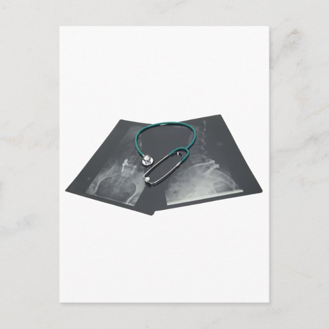 Carte Postale XRayConsult061209 (Devant)