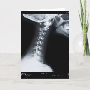 Carte Rayon X des vertèbres de cou comprenant la