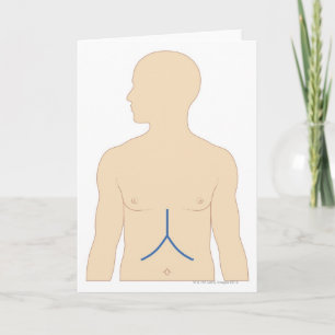 Carte Transplantation du foie