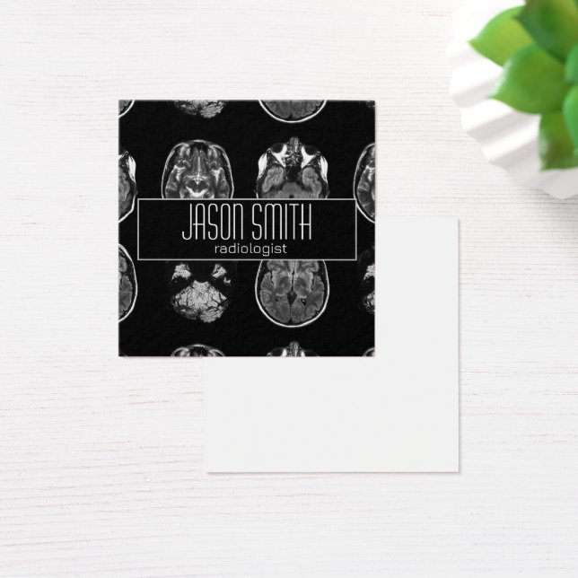 Cartes De Visite Analyse IRM du cerveau (Bureau)