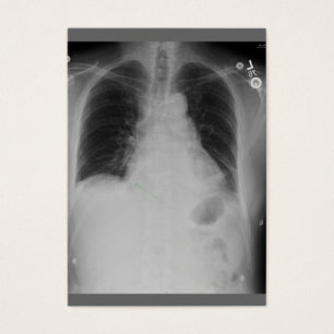 Cartes De Visite ATC cardiaque de ~ de chirurgie