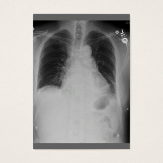 Cartes De Visite Chirurgie cardiaque ~ ATC