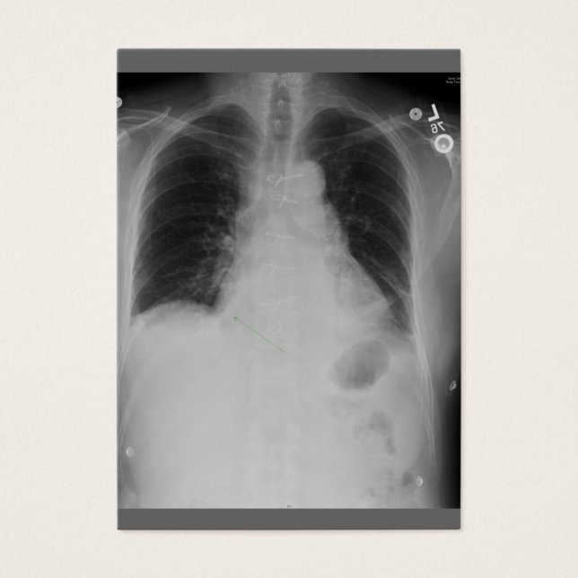 Cartes De Visite Chirurgie cardiaque ~ ATC (Devant)