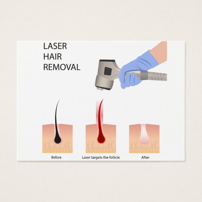Cartes De Visite Élimination des cheveux laser (Devant)