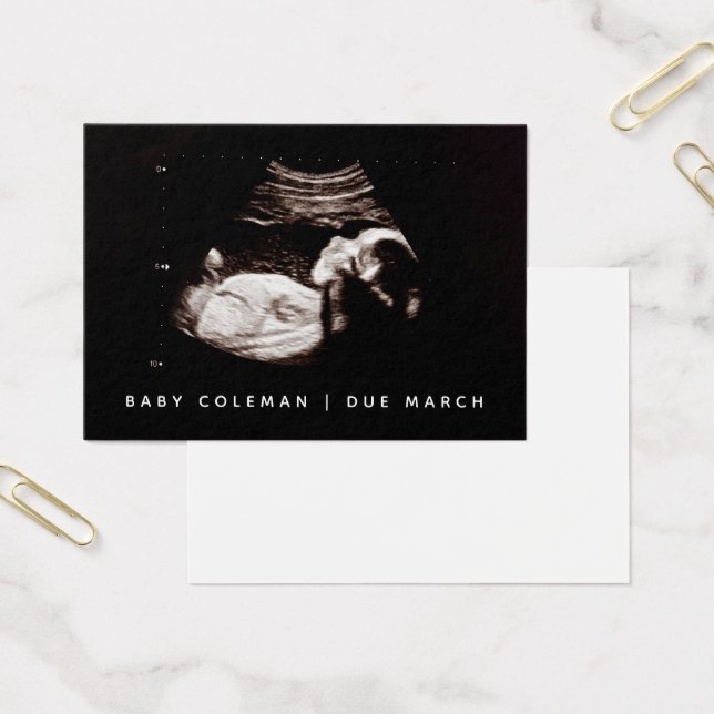 Cartes De Visite Pregnancy Announcement Sonogram Mini Card Pack (Bureau)