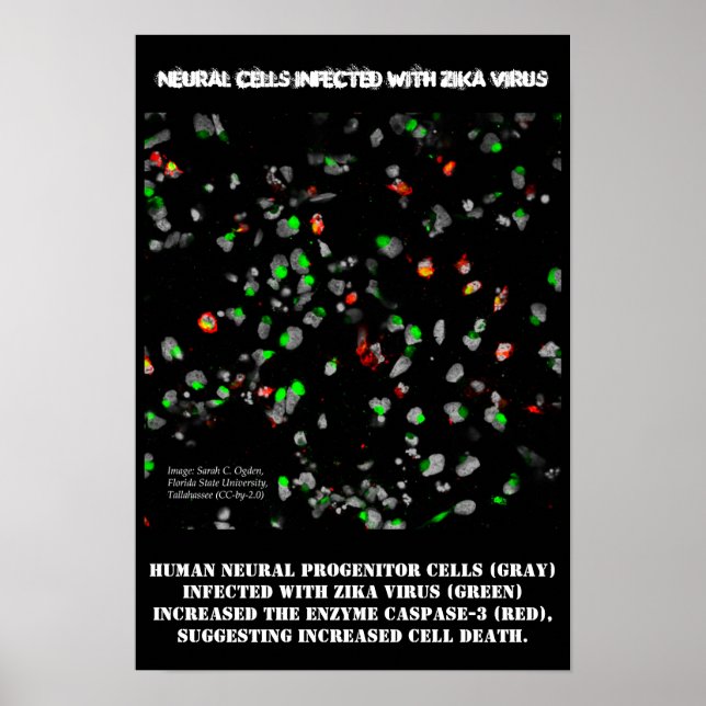 Cellules neuronales infectées avec Poster Zika par (Devant)