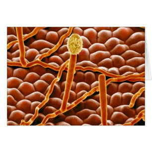 Champignon de rouille pulvérulente sur la