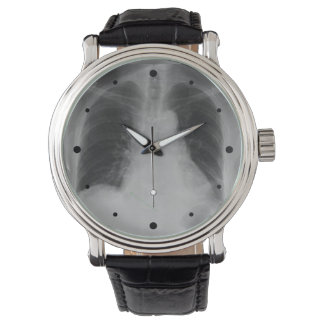 Chest X Ray ~ Montre