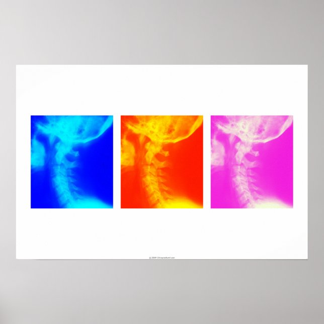 Chiropratique à rayons X cervicaux affiche 2 (Devant)