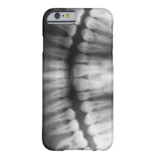 Coque Barely There iPhone 6 X-Ray Teeth Bouche sourire noir et blanc