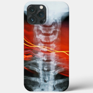 Coque Case-Mate iPhone Boîtier de téléphone numérique X-Ray