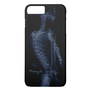Coque iPhone 8 Plus/7 Plus Beau, personnalisé rayon X de corps