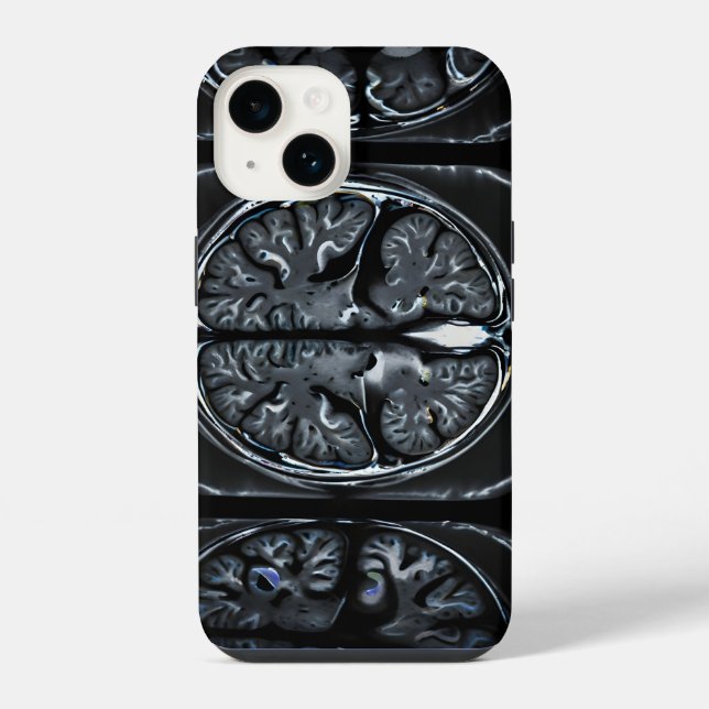 Coque iPhone Analyse cérébrale par IRM (Verso)