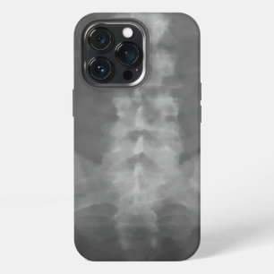 Etui iPhone 13 Pro Art de radiographie numérique