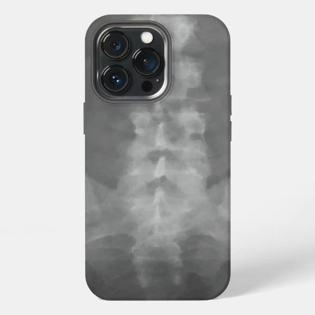 Coque iPhone Art de radiographie numérique (Dos)