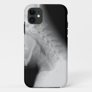 Coque iphone de rayon de mâchoire et d'épine X
