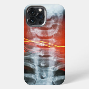 Etui iPhone 13 Pro Max Étui de téléphone en art numérique à rayons X