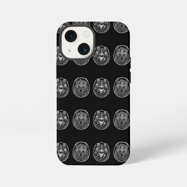 Coque iPhone Examen IRM du cerveau (Verso)